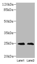 Western blot All lanes: TIMP3 antibody at 2µg/ml Lane 1: EC109 whole cell lysate Lane 2: 293T whole cell lysate Secondary Goat polyclonal to rabbit IgG at 1/10000 dilution Predicted band size: 25 kDa Observed band size: 25 kDa