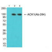 Western blot analysis of extracts from 293 cells (Lane 2) and K562 cells (Lane 3), using ACK1 (Ab-284) antiobdy. The lane on the left is treated with synthesized peptide.