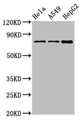 Western Blot Positive WB detected in: Hela whole cell lysate, A549 whole cell lysate, HepG2 whole cell lysate All lanes: TGM2 antibody at 4µg/ml Secondary Goat polyclonal to rabbit IgG at 1/50000 dilution Predicted band size: 78, 62, 39 kDa Observ...
