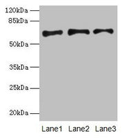 Western blot All lanes: PLAT antibody at 16µg/ml Lane 1: Jurkat whole cell lysate Lane 2: Mouse stomach tissue Lane 3: Mouse kidney tissue Secondary Goat polyclonal to rabbit IgG at 1/10000 dilution Predicted band size: 63, 33, 58, 45 kDa Observed...