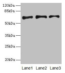 Western blot All lanes: PLAT antibody at 16µg/ml Lane 1: Jurkat whole cell lysate Lane 2: Mouse stomach tissue Lane 3: Mouse kidney tissue Secondary Goat polyclonal to rabbit IgG at 1/10000 dilution Predicted band size: 63, 33, 58, 45 kDa Observed...