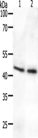 Gel: 10%SDS-PAGE, Lysate: 50 ug, Lane 1-2: Human fetal brain tissue, Human lung tissue, Primary antibody: CSB-PA118294(SYT2 Antibody) at dilution 1/700, Secondary antibody: Goat anti rabbit IgG at 1/8000 dilution, Exposure time: 40 seconds