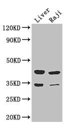 Western Blot Positive WB detected in: Mouse liver tissue, Raji whole cell lysate All lanes: BHMT2 antibody at 3µg/ml Secondary Goat polyclonal to rabbit IgG at 1/50000 dilution Predicted band size: 41, 34 kDa Observed band size: 41, 34 kDa