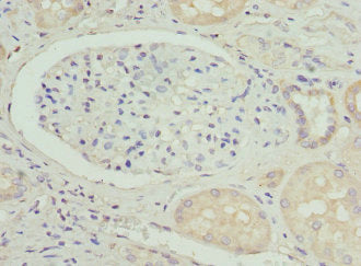 Immunohistochemistry of paraffin-embedded human kidney tissue using CSB-PA11834A0Rb at dilution of 1:100