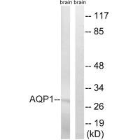 Western blot analysis of extracts from rat brain cells, using AQP1 antibody.