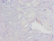 Immunohistochemistry of paraffin-embedded human kidney tissue using CSB-PA11859A0Rb at dilution of 1:20