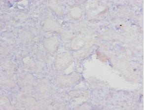 Immunohistochemistry of paraffin-embedded human kidney tissue using CSB-PA11859A0Rb at dilution of 1:20