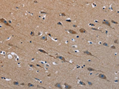 The image on the left is immunohistochemistry of paraffin-embedded Human brain tissue using CSB-PA118655(PLXND1 Antibody) at dilution 1/40, on the right is treated with synthetic peptide. (Original magnification: ×200)