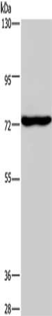 Gel: 6%SDS-PAGE, Lysate: 40 ug, Lane: Mouse brain tissue, Primary antibody: CSB-PA118743(KCND1 Antibody) at dilution 1/400, Secondary antibody: Goat anti rabbit IgG at 1/8000 dilution, Exposure time: 1 minute