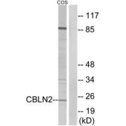Western blot analysis of extracts from COS cells, using CBLN2 antibody.