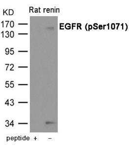 Western blot analysis of extracts from Rat renin using EGFR (Phospho-Ser1071) Antibody.The lane on the left is treated with the antigen-specific peptide.