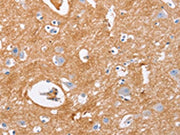 The image on the left is immunohistochemistry of paraffin-embedded Human brain tissue using CSB-PA119606(IGSF8 Antibody) at dilution 1/15, on the right is treated with fusion protein. (Original magnification: ×200)