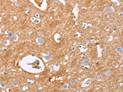 The image on the left is immunohistochemistry of paraffin-embedded Human brain tissue using CSB-PA119606(IGSF8 Antibody) at dilution 1/15, on the right is treated with fusion protein. (Original magnification: ×200)
