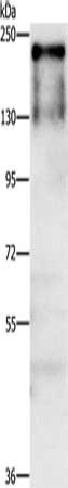 Gel: 8%SDS-PAGE, Lysate: 40 ug, Lane: A431 cells, Primary antibody: CSB-PA119643(ATAD5 Antibody) at dilution 1/750, Secondary antibody: Goat anti rabbit IgG at 1/8000 dilution, Exposure time: 1 minute