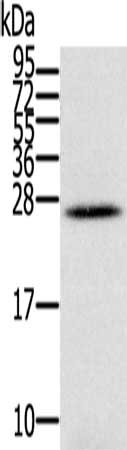 Gel: 12%SDS-PAGE, Lysate: 40 ug, Lane: Human ovarian cancer tissue, Primary antibody: CSB-PA119801(IFNL3 Antibody) at dilution 1/350, Secondary antibody: Goat anti rabbit IgG at 1/8000 dilution, Exposure time: 1 minute