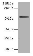Western blot All lanes: ALPI antibody at 2µg/ml + 293T whole cell lysate Secondary Goat polyclonal to rabbit IgG at 1/10000 dilution Predicted band size: 57 kDa Observed band size: 57 kDa