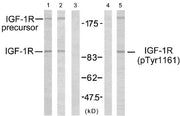 Western blot analysis using IGF-1R (Ab-1161) antibody (Line 1, 2 and 3) and IGF-1R (phospho-Tyr1161) antibody (Line 4 and 5).