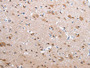 The image on the left is immunohistochemistry of paraffin-embedded Human brain tissue using CSB-PA120126(CFC1 Antibody) at dilution 1/20, on the right is treated with synthetic peptide. (Original magnification: ×200)