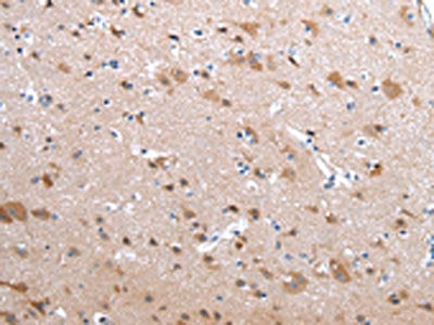 The image on the left is immunohistochemistry of paraffin-embedded Human brain tissue using CSB-PA120126(CFC1 Antibody) at dilution 1/20, on the right is treated with synthetic peptide. (Original magnification: ×200)
