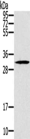 Gel: 12%SDS-PAGE, Lysate: 40 ug, Lane: SP20 cells, Primary antibody: CSB-PA120268(DKK1 Antibody) at dilution 1/200, Secondary antibody: Goat anti rabbit IgG at 1/8000 dilution, Exposure time: 1 minute