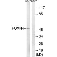 Western blot analysis of extracts from LOVO cells, using FOXN4 antibody.