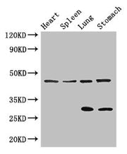 Western Blot Positive WB detected in: Mouse heart tissue, Mouse spleen tissue, Mouse lung tissue, Mouse stomach tissue All lanes: REN antibody at 3ug/ml Secondary Goat polyclonal to rabbit IgG at 1/50000 dilution Predicted band size: 46, 45 kDa Ob...