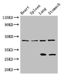 Western Blot Positive WB detected in: Mouse heart tissue, Mouse spleen tissue, Mouse lung tissue, Mouse stomach tissue All lanes: REN antibody at 3ug/ml Secondary Goat polyclonal to rabbit IgG at 1/50000 dilution Predicted band size: 46, 45 kDa Ob...
