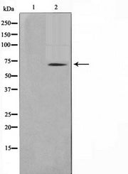 Western blot analysis on NIH-3T3 cell lysate using TGFR2 Antibody