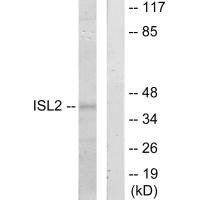 Western blot analysis of extracts from 293 cells, using ISL2 antibody.