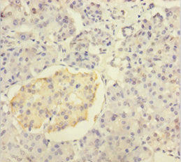 Immunohistochemistry of paraffin-embedded human pancreatic tissue using CSB-PA12089A0Rb at dilution of 1:100