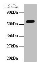 Western blot All lanes: ICA1 antibody at 2µg/ml + A549 whole cell lysate Secondary Goat polyclonal to rabbit IgG at 1/10000 dilution Predicted band size: 55, 58 kDa Observed band size: 55 kDa