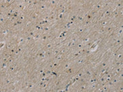 The image on the left is immunohistochemistry of paraffin-embedded Human brain tissue using CSB-PA121728(ROBO4 Antibody) at dilution 1/25, on the right is treated with fusion protein. (Original magnification: ×200)