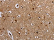 The image on the left is immunohistochemistry of paraffin-embedded Human brain tissue using CSB-PA121845(MTBP Antibody) at dilution 1/40, on the right is treated with synthetic peptide. (Original magnification: ×200)