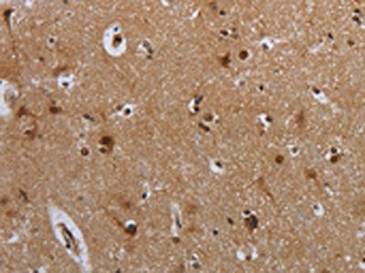 The image on the left is immunohistochemistry of paraffin-embedded Human brain tissue using CSB-PA121845(MTBP Antibody) at dilution 1/40, on the right is treated with synthetic peptide. (Original magnification: ×200)