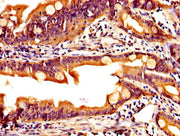 IHC image of CSB-PA12214A0Rb diluted at 1:200 and staining in paraffin-embedded human small intestine tissue performed on a Leica BondTM system. After dewaxing and hydration, antigen retrieval was mediated by high pressure in a citrate buffer (pH...