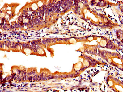 IHC image of CSB-PA12214A0Rb diluted at 1:200 and staining in paraffin-embedded human small intestine tissue performed on a Leica BondTM system. After dewaxing and hydration, antigen retrieval was mediated by high pressure in a citrate buffer (pH...