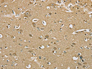 The image on the left is immunohistochemistry of paraffin-embedded Human brain tissue using CSB-PA122539(SERINC1 Antibody) at dilution 1/30, on the right is treated with synthetic peptide. (Original magnification: ×200)