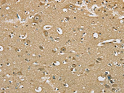 The image on the left is immunohistochemistry of paraffin-embedded Human brain tissue using CSB-PA122539(SERINC1 Antibody) at dilution 1/30, on the right is treated with synthetic peptide. (Original magnification: ×200)