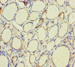 Immunohistochemistry of paraffin-embedded human thyroid tissue using CSB-PA12279A0RB at dilution of 1:100
