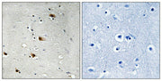 Immunohistochemical analysis of paraffin-embedded human brain tissue using E2A (Phospho-Thr355) antibody (left)or the same antibody preincubated with blocking peptide (right).