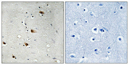 Immunohistochemical analysis of paraffin-embedded human brain tissue using E2A (Phospho-Thr355) antibody (left)or the same antibody preincubated with blocking peptide (right).