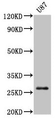 Western Blot Positive WB detected in: U87 whole cell lysate All lanes: PRSS3 antibody at 3µg/ml Secondary Goat polyclonal to rabbit IgG at 1/50000 dilution Predicted band size: 33, 29, 27, 26 kDa Observed band size: 27 kDa