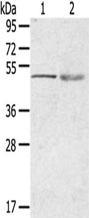 Gel: 8%SDS-PAGE,Lysate: 40 ug,Lane 1-2: 231 cells, Human breast infiltrative duct tissue,Primary antibody: CSB-PA123241(RHCE Antibody) at dilution 1/200 dilution,Secondary antibody: Goat anti rabbit IgG at 1/8000 dilution,Exposure time: 1 minute