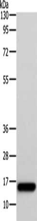 Gel: 12+15%SDS-PAGE, Lysate: 40 ug, Lane: Human fetal muscle tissue, Primary antibody: CSB-PA123571(AP2S1 Antibody) at dilution 1/250, Secondary antibody: Goat anti rabbit IgG at 1/8000 dilution, Exposure time: 1 minute