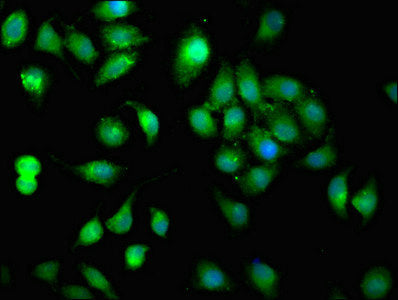 Immunofluorescent analysis of A549 cells using CSB-PA12369A0Rb at dilution of 1:100 and Alexa Fluor 488-congugated AffiniPure Goat Anti-Rabbit IgG(H+L)
