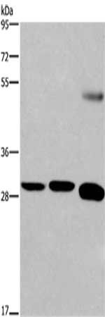 Gel: 8%SDS-PAGE,Lysate: 40 ug,Lane 1-3: Human hepatocellsular carcinoma tissue, LNCap cells, Human testis tissue,Primary antibody: CSB-PA123716(FGF8 Antibody) at dilution 1/300 dilution,Secondary antibody: Goat anti rabbit IgG at 1/8000 dilution,E...