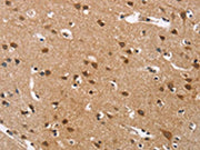 The image on the left is immunohistochemistry of paraffin-embedded Human brain tissue using CSB-PA123907(CACNA1D Antibody) at dilution 1/40, on the right is treated with synthetic peptide. (Original magnification: ×200)