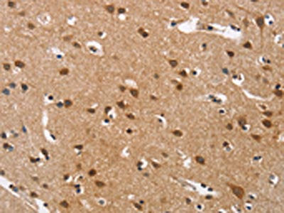 The image on the left is immunohistochemistry of paraffin-embedded Human brain tissue using CSB-PA123907(CACNA1D Antibody) at dilution 1/40, on the right is treated with synthetic peptide. (Original magnification: ×200)