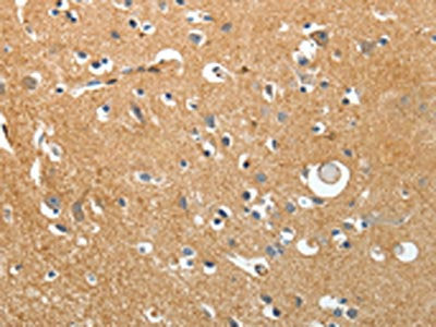 The image on the left is immunohistochemistry of paraffin-embedded Human brain tissue using CSB-PA123979(AKAP12 Antibody) at dilution 1/40, on the right is treated with synthetic peptide. (Original magnification: ×200)