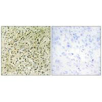 Immunohistochemistry analysis of paraffin-embedded human prostate carcinoma tissue, using RHG07 antibody.